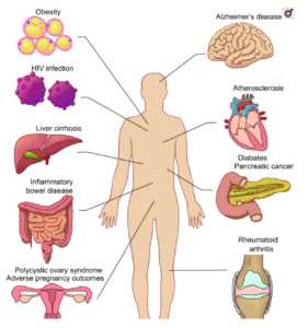 Microbiome