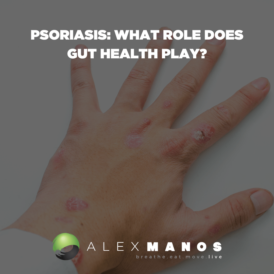 Psoriasis: What Role Does Gut Health Play?