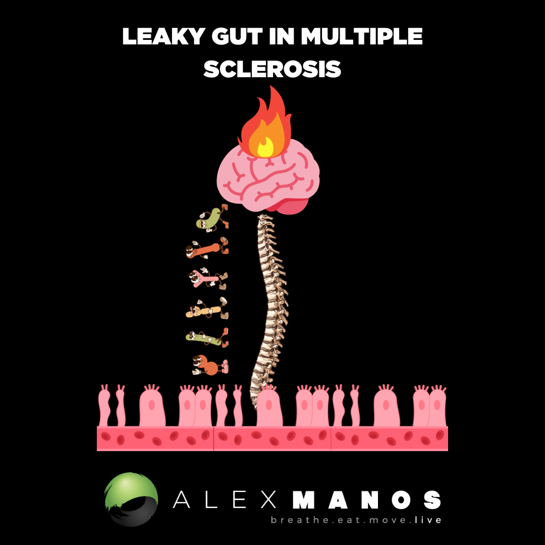 Leaky Gut In Multiple Sclerosis